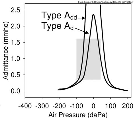 tympanometry type ad|Iba pa.